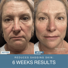 Load image into Gallery viewer, New LIFTAURA Pro + Free Revitalize Serum